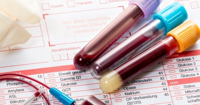 Blutt Test fir Mënsch Papillomavirus