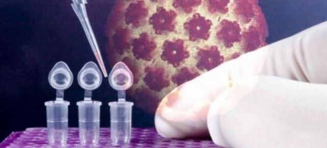 HPV Diagnostik mam Digene Test benotzt